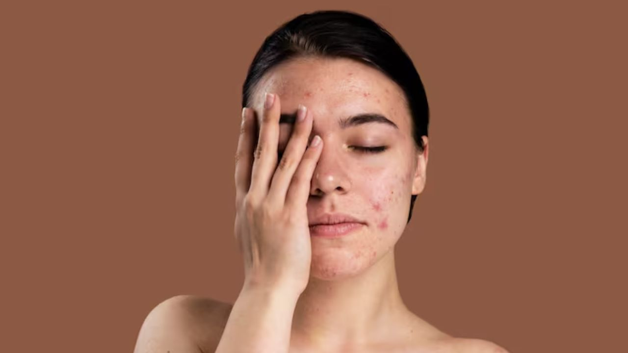 skin care tips