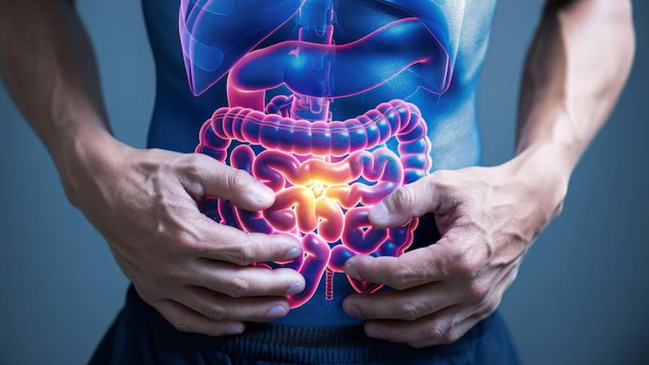 colon cancer