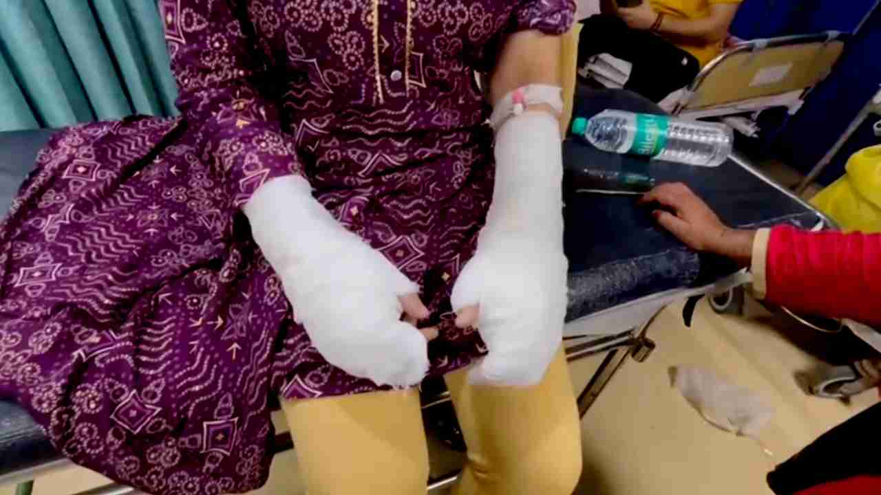 Women with injured hand । Photo Credit: PTI