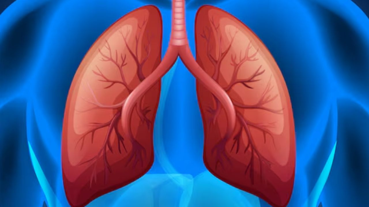 Lung Cancer