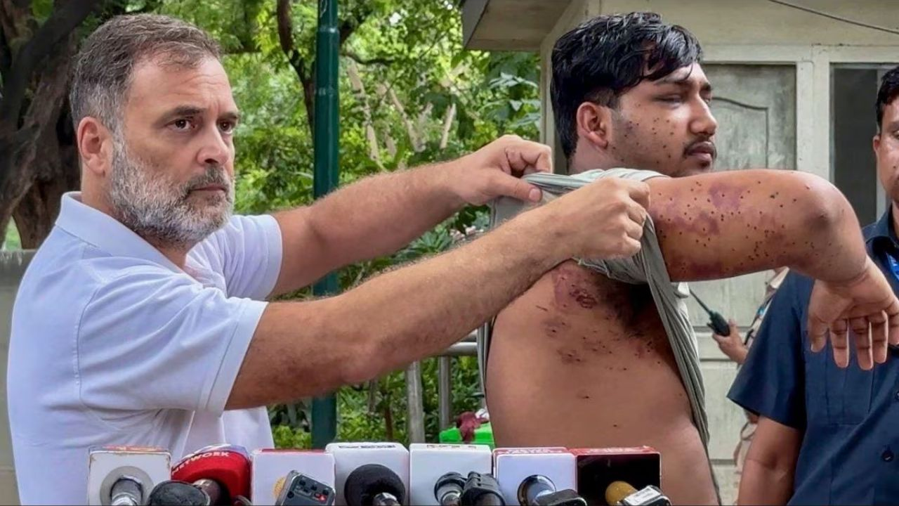 man injured with pallet gun