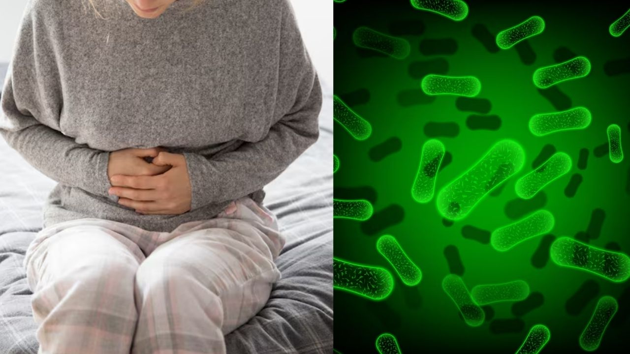 shigella infection
