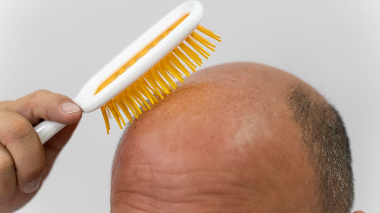 Image of Bald Head