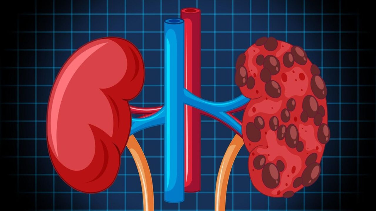 kidney