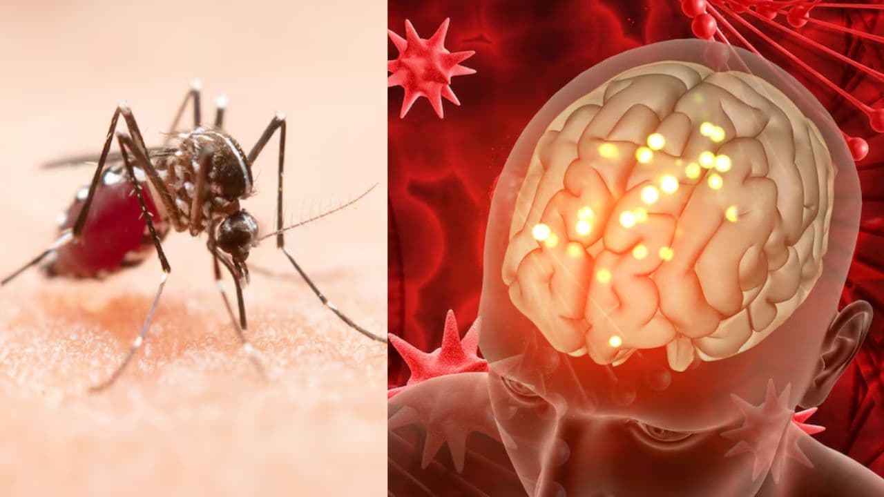 cerebral malaria