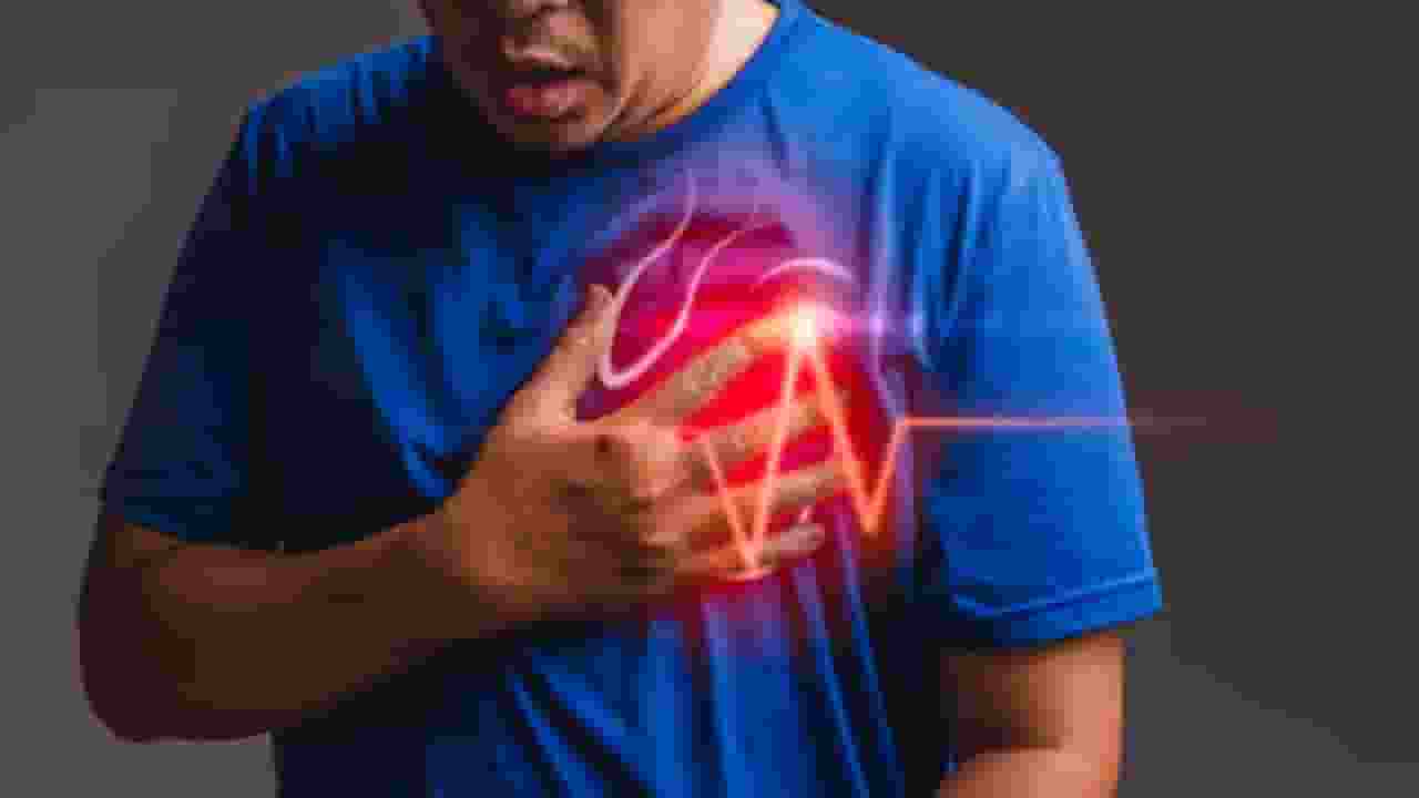 Broken Heart Syndrome