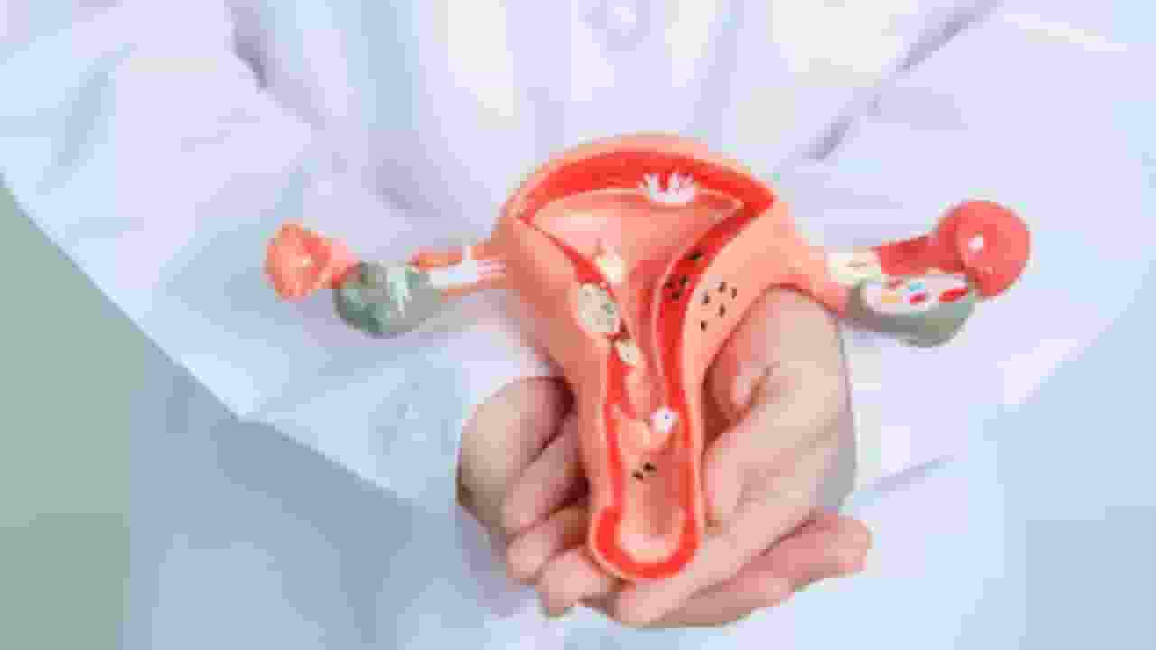 सर्वाइकल कैंसर: बचाव से वैक्सिनेशन तक, सब कुछ जो आप जानना चाहते हैं
cervical cancer