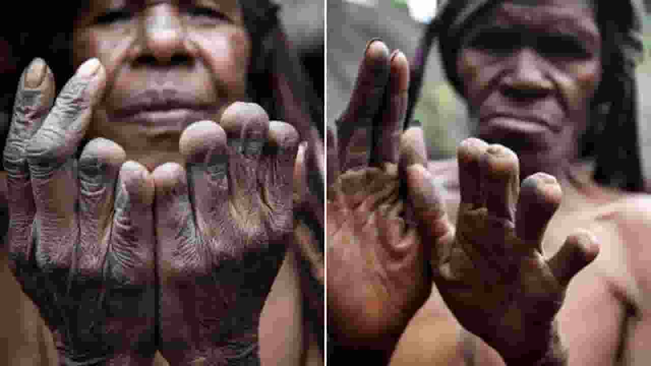 रिवाज या बेवकूफी! कोई मर जाए तो काट डालते हैं घर की औरतों की उंगली Dani Tribe weird Rituals