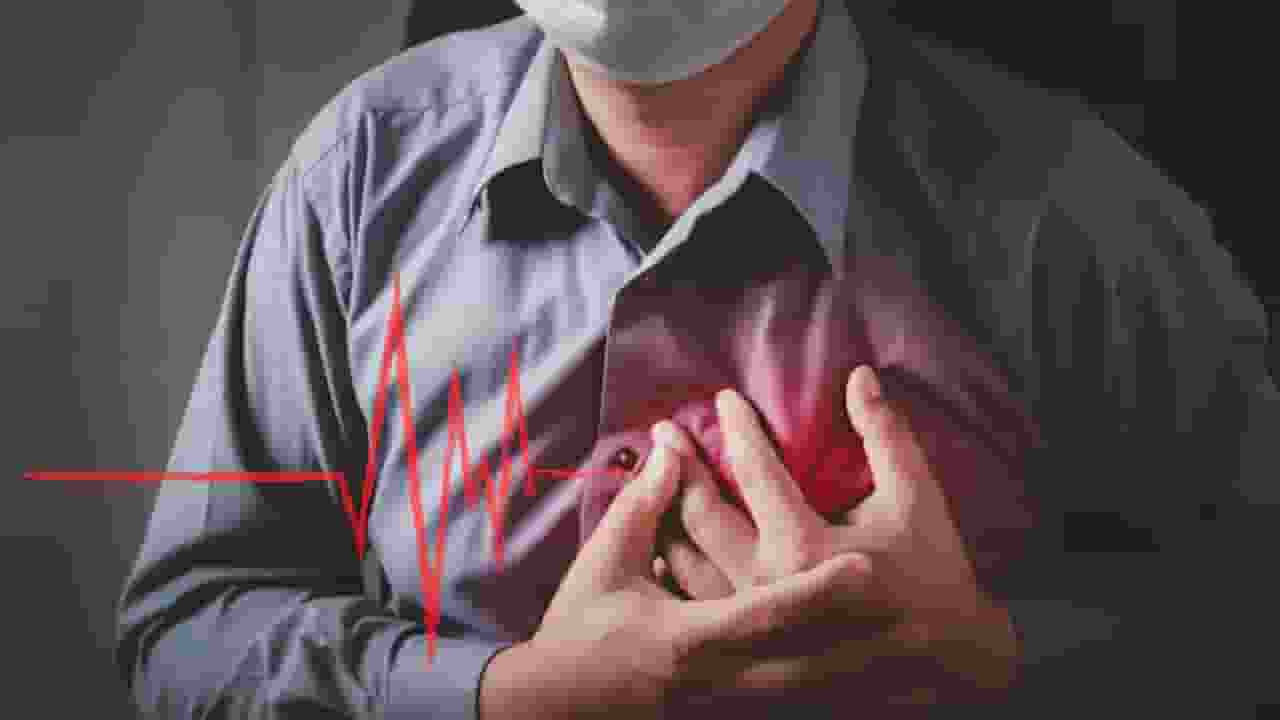 heart attack representative photo