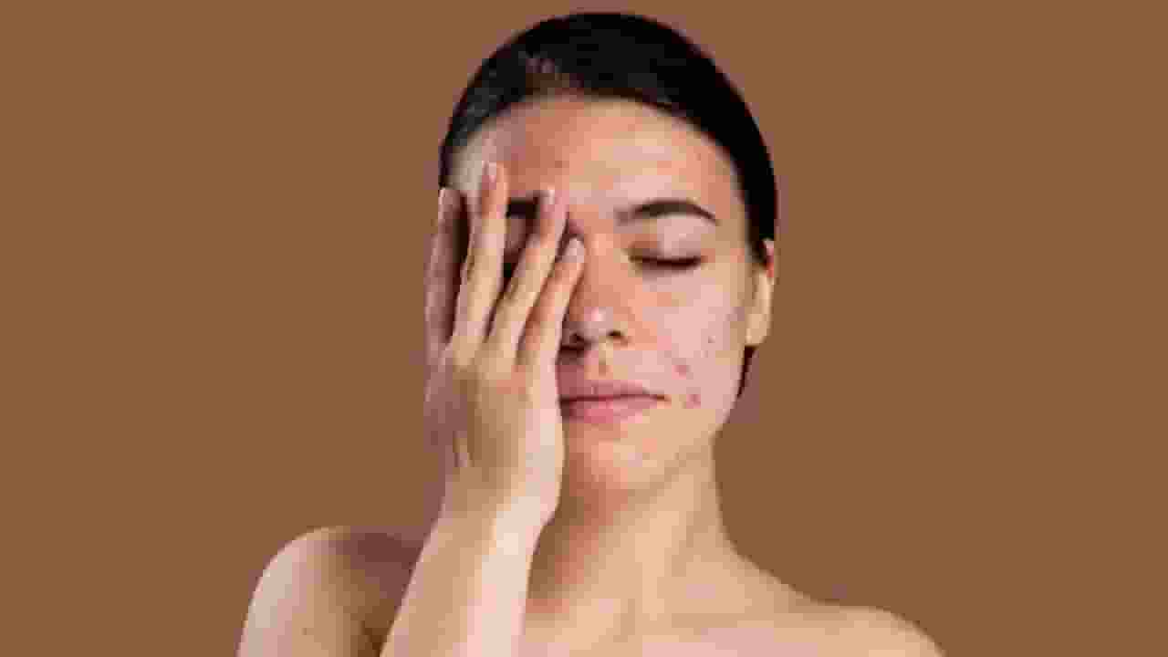 Skin care tips monsoon