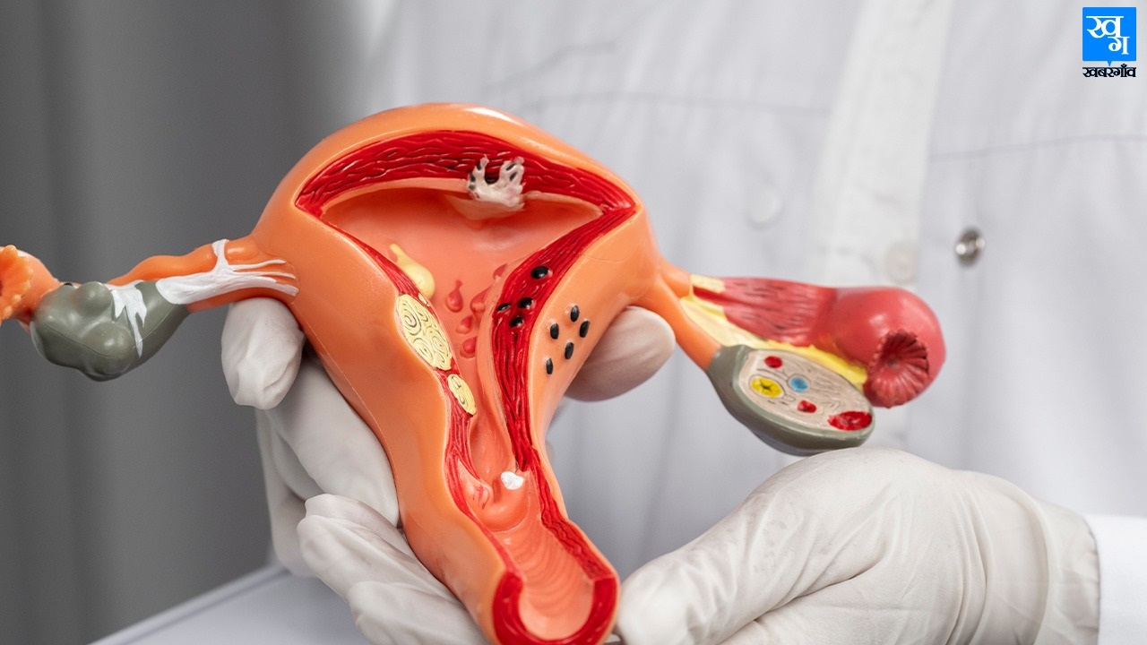 स्क्रीनिंग से इलाज तक, सर्वाइकल कैंसर पर सरकार का प्लान क्या है? Cervical cancer